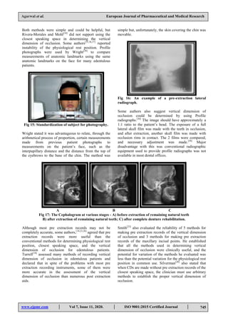 Pre Extraction Evaluation PRE-EXTRACTION RECORDS ARE RELIABLE TOOL FOR COMPLETE DENTURE ...