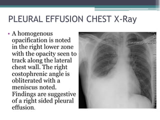 1607662194154_RADIOLOGICAL ANATOMY AND PATHOLOGY OF THORAX.pdf