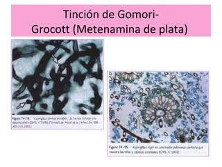 160836304 diagnostico-histologico-de-micosis-finished | PPT