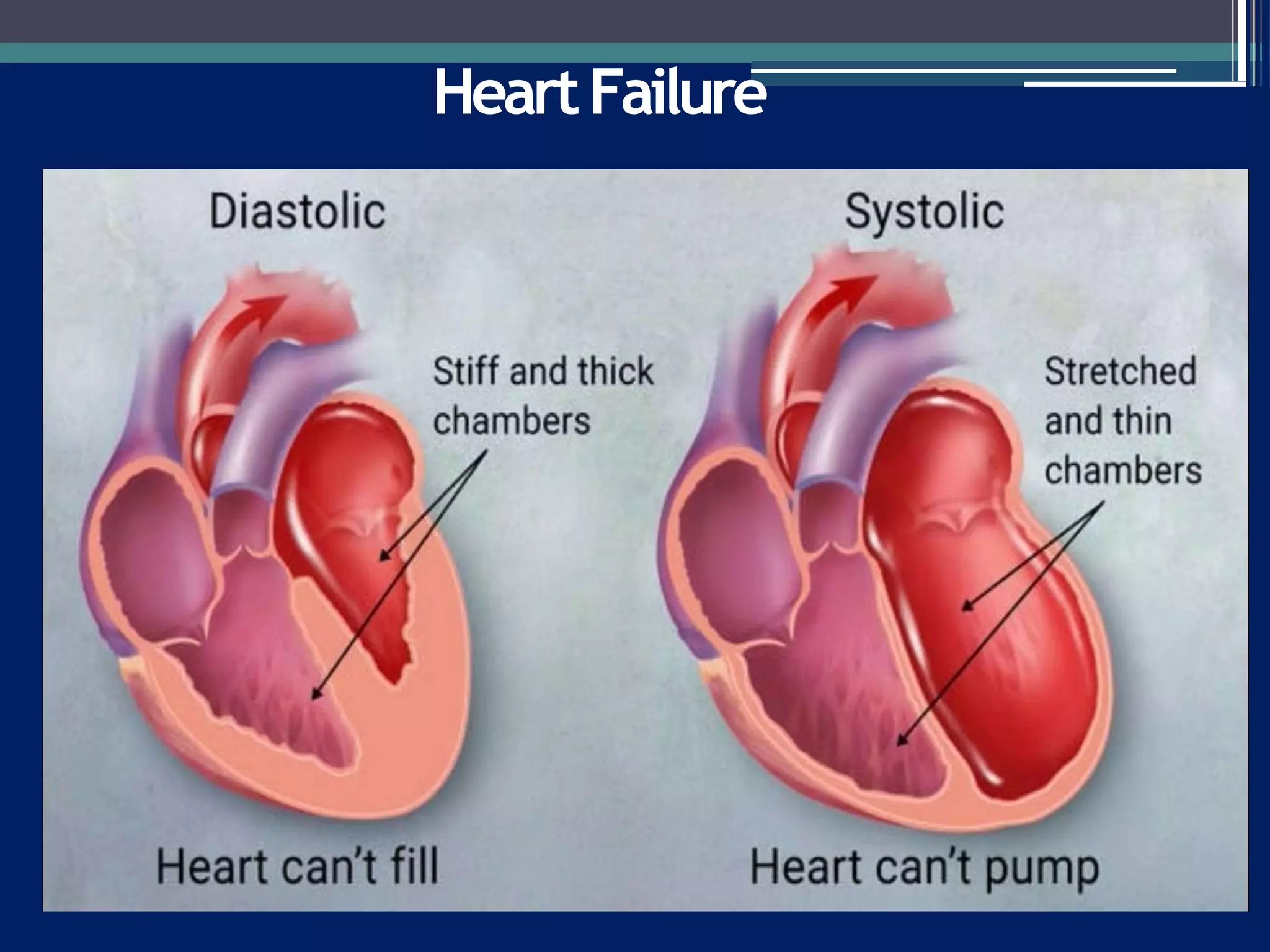 heart failure bpt