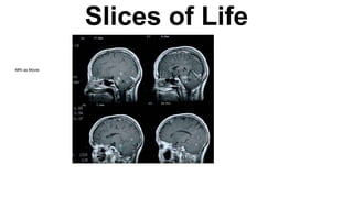 Slices of Life
MRI as Movie
 