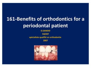 161-Benefits of orthodontics for a
periodontal patient
O.SANDID
SQODF
spécialiste qualifié en orthodontie
2007
 