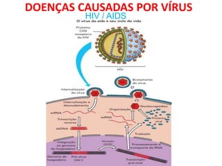 DOENÇAS CAUSADAS POR VÍRUS
HIV / AIDS
 
