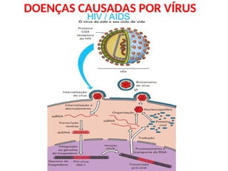 DOENÇAS CAUSADAS POR VÍRUS
HIV / AIDS
 