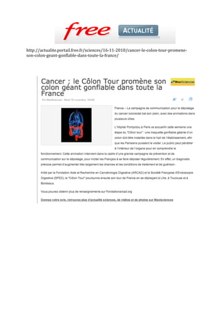 http://actualite.portail.free.fr/sciences/16‐11‐2010/cancer‐le‐colon‐tour‐promene‐
son‐colon‐geant‐gonflable‐dans‐toute‐la‐france/ 
 
 
 