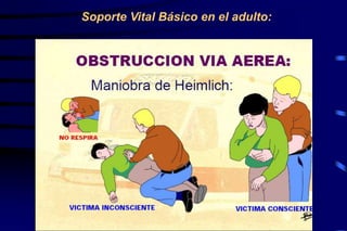 Soporte Vital Básico en el adulto:
 