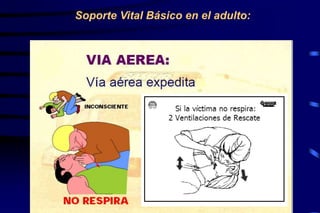 Soporte Vital Básico en el adulto:
911
 