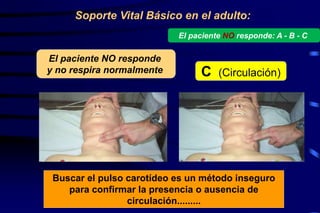 El paciente NO responde
y no respira normalmente
Soporte Vital Básico en el adulto:
C (Circulación)
Buscar el pulso carotídeo es un método inseguro
para confirmar la presencia o ausencia de
circulación.........
El paciente NO responde: A - B - C
 