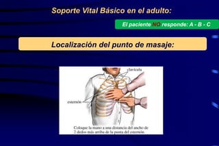 Localización del punto de masaje:
Soporte Vital Básico en el adulto:
El paciente NO responde: A - B - C
 