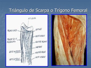 Triángulo de Scarpa o Trígono Femoral
 