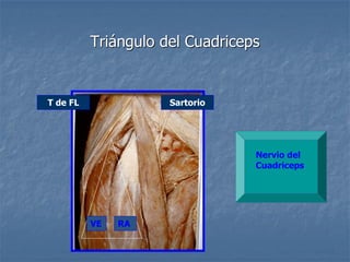 Triángulo del Cuadriceps
T de FL Sartorio
RA
VE
Nervio del
Cuadriceps
 