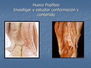 Hueco Poplíteo
Investigar y estudiar conformación y
contenido
 