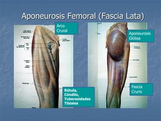 Aponeurosis Femoral (Fascia Lata)
Arco
Crural
Aponeurosis
Glútea
Rótula,
Cóndilo,
Tuberosidades
Tibiales
Fascia
Cruris
 