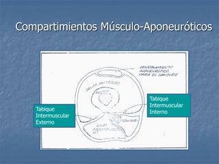 Compartimientos Músculo-Aponeuróticos
Tabique
Intermuscular
Interno
Tabique
Intermuscular
Externo
 