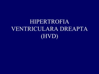 HIPERTROFIA
VENTRICULARA DREAPTA
(HVD)
 