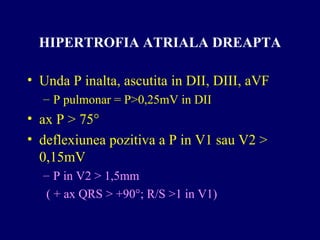 HIPERTROFIA ATRIALA DREAPTA
• Unda P inalta, ascutita in DII, DIII, aVF
– P pulmonar = P>0,25mV in DII
• ax P > 75°
• deflexiunea pozitiva a P in V1 sau V2 >
0,15mV
– P in V2 > 1,5mm
( + ax QRS > +90°; R/S >1 in V1)
 