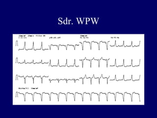Sdr. WPW
 