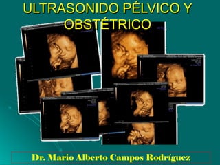 Dr. Mario Alberto Campos Rodríguez
ULTRASONIDO PÉLVICO YULTRASONIDO PÉLVICO Y
OBSTÉTRICOOBSTÉTRICO
 