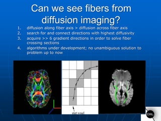 mapping the mouse brain - youtube Images High Quality... Advanced MRI Imaging Combined with Intraoperative MRI for Brain Tumors ...
