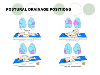 POSTURAL DRAINAGE POSITIONS 