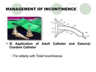 MANAGEMENT OF INCONTINENCE 5) Application of Adult Catheter and External Condom Catheter For elderly with Total Incontinence   