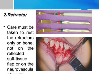 2-Retractor
• Care must be
taken to rest
the retractors
only on bone,
not on the
reflected
soft-tissue
flap or on the
neurovascula
 
