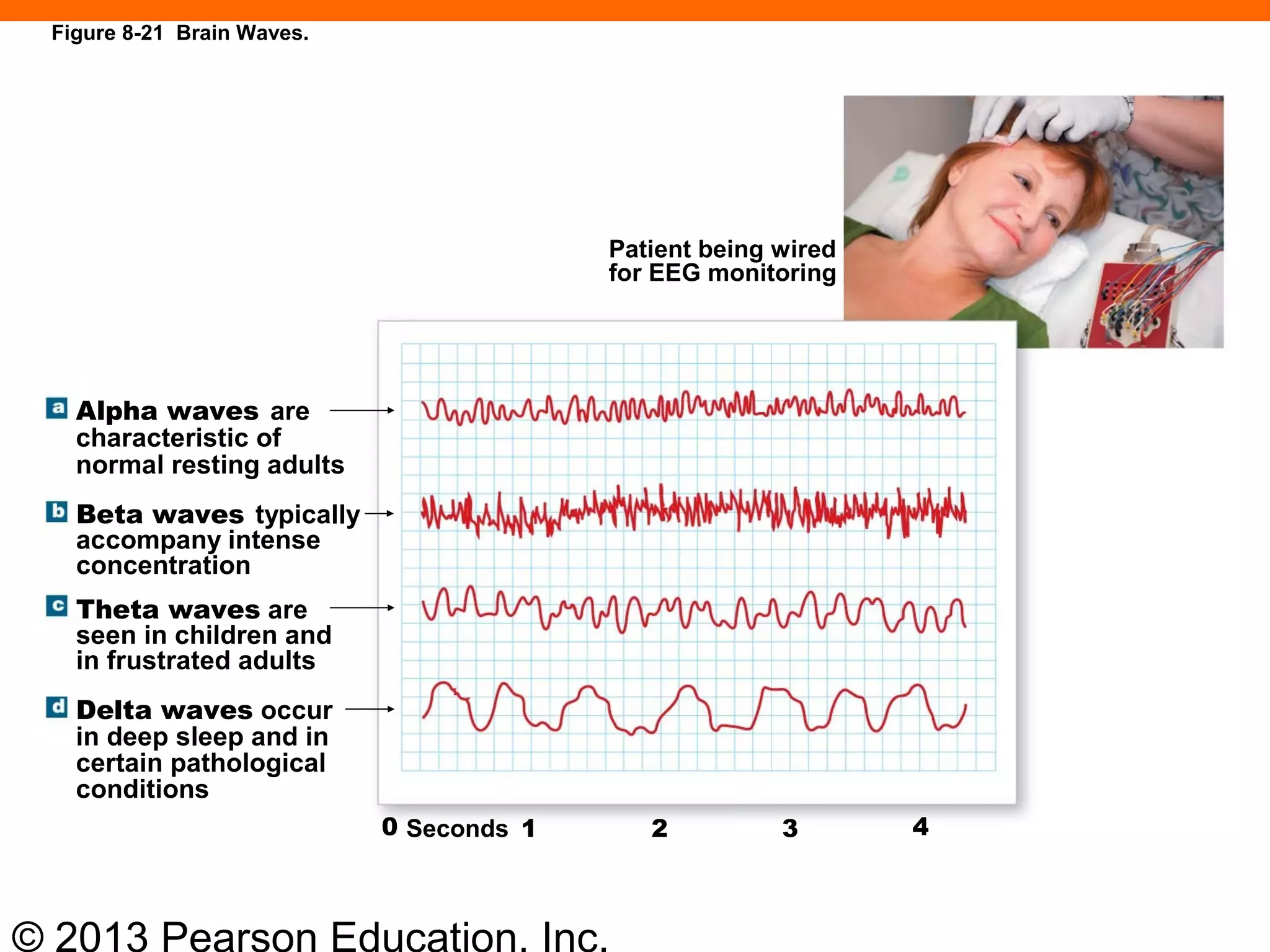 © 2013 Pearson Education, Inc.
Patient being wired
for EEG monitoring
Alpha waves are
characteristic of
normal resting adults
Beta waves typically
accompany intense
concentration
Theta waves are
seen in children and
in frustrated adults
Delta waves occur
in deep sleep and in
certain pathological
conditions
0 1 2 3 4Seconds
Figure 8-21 Brain Waves.
 