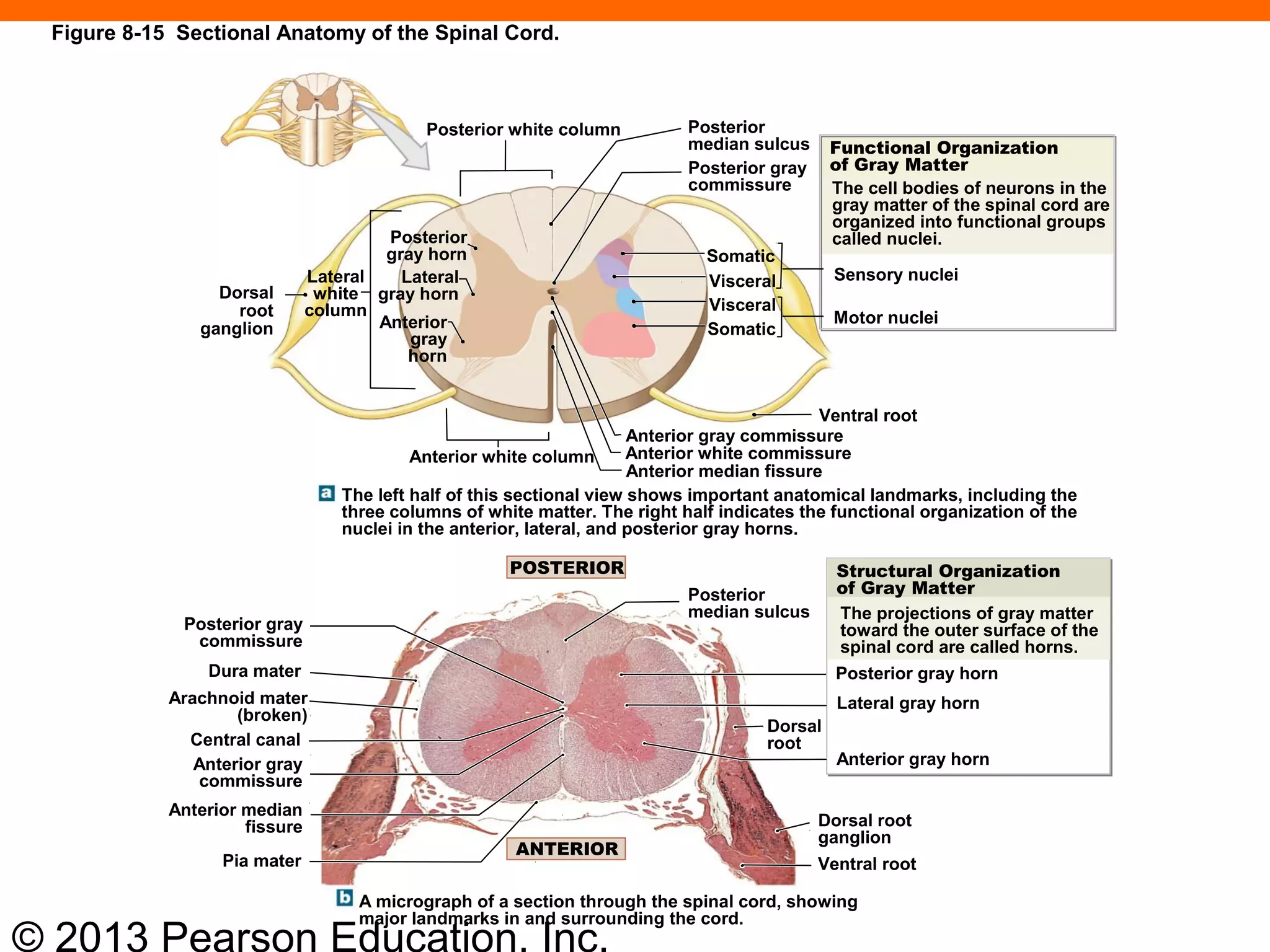 © 2013 Pearson Education, Inc.
Posterior white column
Dorsal
root
ganglion
Lateral
white
column
Posterior
gray horn
Lateral
gray horn
Anterior
gray
horn
Posterior
median sulcus
Posterior gray
commissure
Somatic
Visceral
Visceral
Somatic
Functional Organization
of Gray Matter
The cell bodies of neurons in the
gray matter of the spinal cord are
organized into functional groups
called nuclei.
Sensory nuclei
Motor nuclei
Ventral root
Anterior gray commissure
Anterior white commissure
Anterior median fissure
Anterior white column
The left half of this sectional view shows important anatomical landmarks, including the
three columns of white matter. The right half indicates the functional organization of the
nuclei in the anterior, lateral, and posterior gray horns.
Posterior
median sulcus
POSTERIOR Structural Organization
of Gray Matter
The projections of gray matter
toward the outer surface of the
spinal cord are called horns.
Posterior gray horn
Lateral gray horn
Anterior gray horn
Dorsal
root
Dorsal root
ganglion
Ventral root
Posterior gray
commissure
Dura mater
Arachnoid mater
(broken)
Central canal
Anterior gray
commissure
Anterior median
fissure
Pia mater
A micrograph of a section through the spinal cord, showing
major landmarks in and surrounding the cord.
ANTERIOR
Figure 8-15 Sectional Anatomy of the Spinal Cord.
 