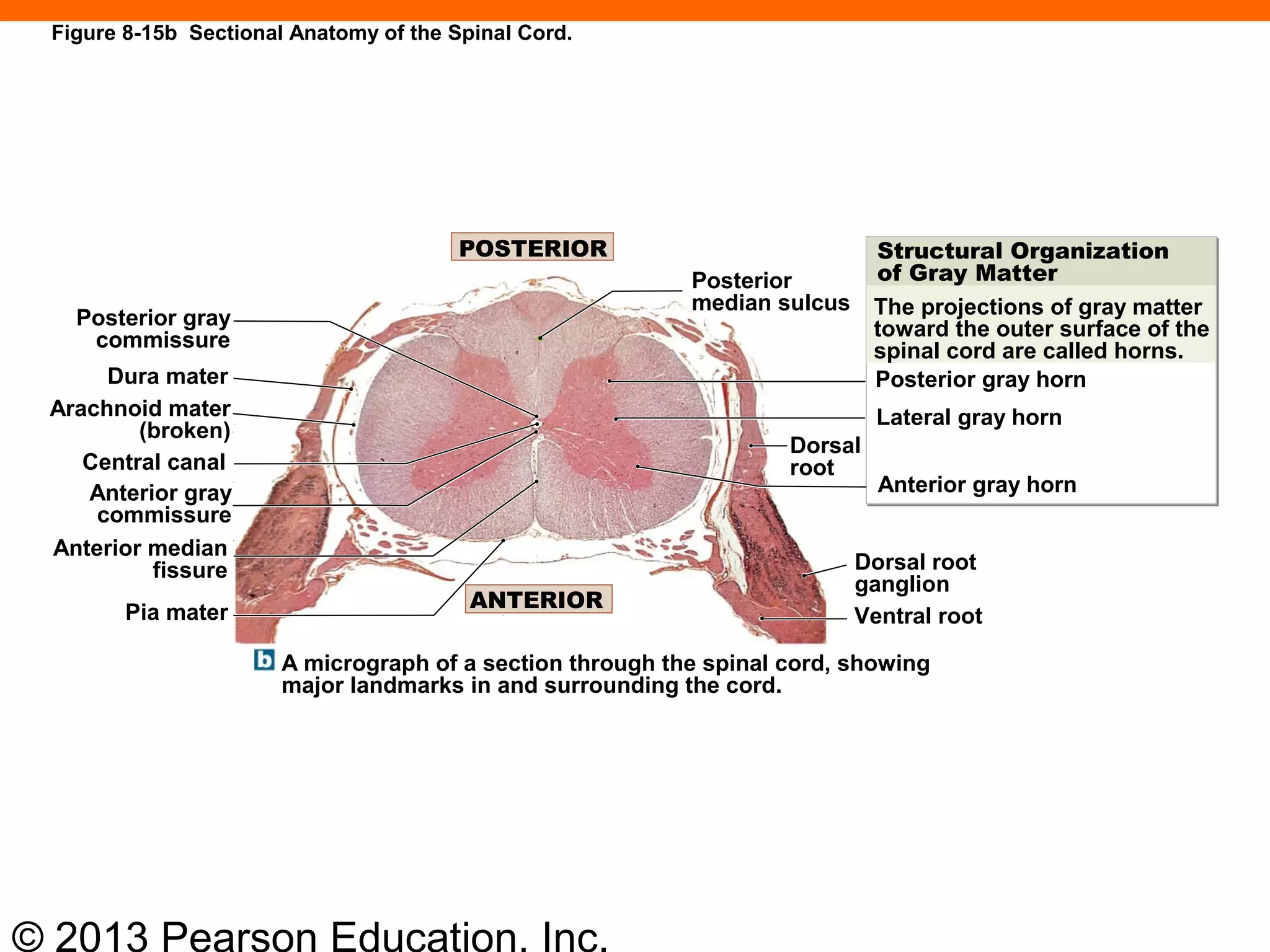 © 2013 Pearson Education, Inc.
Figure 8-15b Sectional Anatomy of the Spinal Cord.
A micrograph of a section through the spinal cord, showing
major landmarks in and surrounding the cord.
Pia mater
Anterior median
fissure
Anterior gray
commissure
Central canal
Arachnoid mater
(broken)
Dura mater
Posterior gray
commissure
POSTERIOR
ANTERIOR
Posterior
median sulcus
Dorsal
root
Dorsal root
ganglion
Ventral root
Structural Organization
of Gray Matter
Posterior gray horn
Lateral gray horn
Anterior gray horn
The projections of gray matter
toward the outer surface of the
spinal cord are called horns.
 