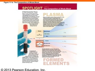 © 2013 Pearson Education, Inc.
SPOTLIGHT
FIGURE 11-1
The Composition of Whole Blood
Blood is a fluid connective tissue with a
unique composition. It consists of a matrix
called plasma (PLAZ-muh) and formed
elements (cells and cell fragments). The term
whole blood refers to the combination of
plasma and the formed elements together.
The cardiovascular system of an adult male
contains 5–6 liters (5.3–6.4 quarts) of whole
blood; that of an adult female contains 4–5
liters (4.2–5.3 quarts). The sex differences in
blood volume primarily
reflect differences in
average body size.
Plasma, the matrix of blood, makes up about 55% of the
volume of whole blood. In many respects, the
composition of plasma resembles that of interstitial
fluid. This similarity exists because water, ions, and
small solutes are continuously exchanged between
plasma and interstitial fluids across the walls of
capillaries. The primary differences between plasma and
interstitial fluid involve (1) the levels of respiratory gases
(oxygen and carbon dioxide, due to the respiratory
activities of tissue cells), and (2) the concentrations and
types of dissolved proteins (because plasma proteins
cannot cross capillary walls).
PLASMA
A Fluid Connective Tissue
55%
(Range: 46–63%)
Plasma
consists of
1%
92%
Plasma Proteins
Other Solutes
Water
< .1%
99.9%
< .1%
The hematocrit
(he-MAT-ō-krit) is the
percentage of whole
blood volume contributed
by formed elements. The
normal hematocrit, or packed cell
volume (PCV), in adult males is 46 and in
adult females is 42. The sex difference in
hematocrit primarily reflects the fact that
androgens (male hormones) stimulate red
blood cell production, whereas estrogens
(female hormones) do not.
Formed elements are blood cells and cell
fragments that are suspended in plasma. These
elements account for about 45% of the volume of
whole blood. Three types of formed elements exist:
platelets, white blood cells, and red blood cells.
Formed elements are produced through the
process of hemopoiesis (hēm-ō-poy-Ē-sis). Two
populations of stem cells—myeloid stem cells and
lymphoid stem cells—are responsible for the
production of formed elements.
FORMED
ELEMENTS
Platelets
White Blood Cells
Red Blood Cells
Formed Elements
45%
(Range: 37–54%)
7%
Figure 11-1a The Composition of Whole Blood
 