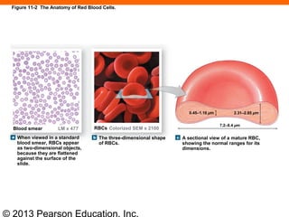 © 2013 Pearson Education, Inc.
Figure 11-2 The Anatomy of Red Blood Cells.
When viewed in a standard
blood smear, RBCs appear
as two-dimensional objects,
because they are flattened
against the surface of the
slide.
The three-dimensional shape
of RBCs.
A sectional view of a mature RBC,
showing the normal ranges for its
dimensions.
0.45–1.16 µm 2.31–2.85 µm
7.2–8.4 µm
Colorized SEM x 2100RBCsLM x 477Blood smear
 