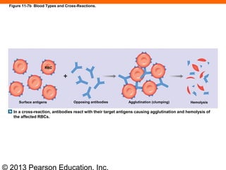 © 2013 Pearson Education, Inc.
Figure 11-7b Blood Types and Cross-Reactions.
RBC
Surface antigens Opposing antibodies Agglutination (clumping) Hemolysis
In a cross-reaction, antibodies react with their target antigens causing agglutination and hemolysis of
the affected RBCs.
 