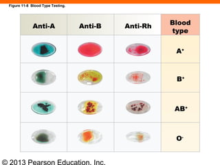 © 2013 Pearson Education, Inc.
Figure 11-8 Blood Type Testing.
Anti-A Anti-B Anti-Rh
Blood
type
A+
B+
AB+
O-
 