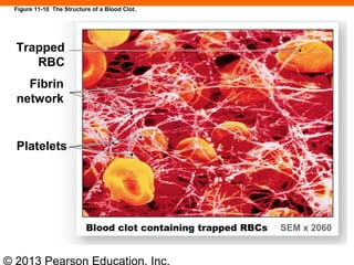 © 2013 Pearson Education, Inc.
Figure 11-10 The Structure of a Blood Clot.
Trapped
RBC
Fibrin
network
Platelets
Blood clot containing trapped RBCs SEM x 2060
 