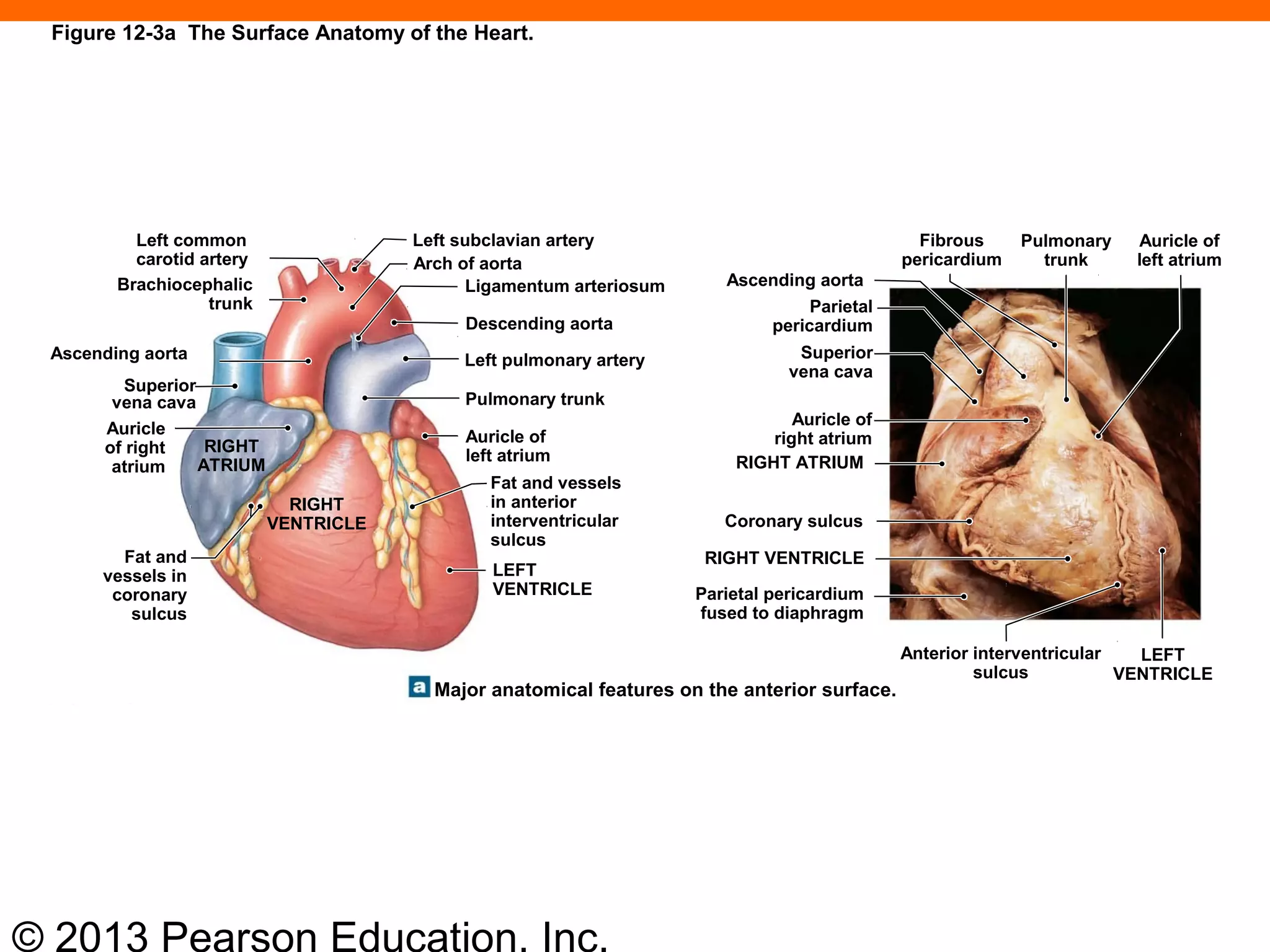 © 2013 Pearson Education, Inc.
Figure 12-3a The Surface Anatomy of the Heart.
Left common
carotid artery
Brachiocephalic
trunk
Ascending aorta
Superior
vena cava
Auricle
of right
atrium
RIGHT
ATRIUM
Fat and
vessels in
coronary
sulcus
Left subclavian artery
Arch of aorta
Ligamentum arteriosum
Descending aorta
Left pulmonary artery
Pulmonary trunk
Auricle of
left atrium
Fat and vessels
in anterior
interventricular
sulcus
LEFT
VENTRICLE
Ascending aorta
Parietal
pericardium
Superior
vena cava
Auricle of
right atrium
RIGHT ATRIUM
Coronary sulcus
RIGHT VENTRICLE
Parietal pericardium
fused to diaphragm
Anterior interventricular
sulcus
LEFT
VENTRICLE
Auricle of
left atrium
Pulmonary
trunk
Fibrous
pericardium
Major anatomical features on the anterior surface.
RIGHT
VENTRICLE
 