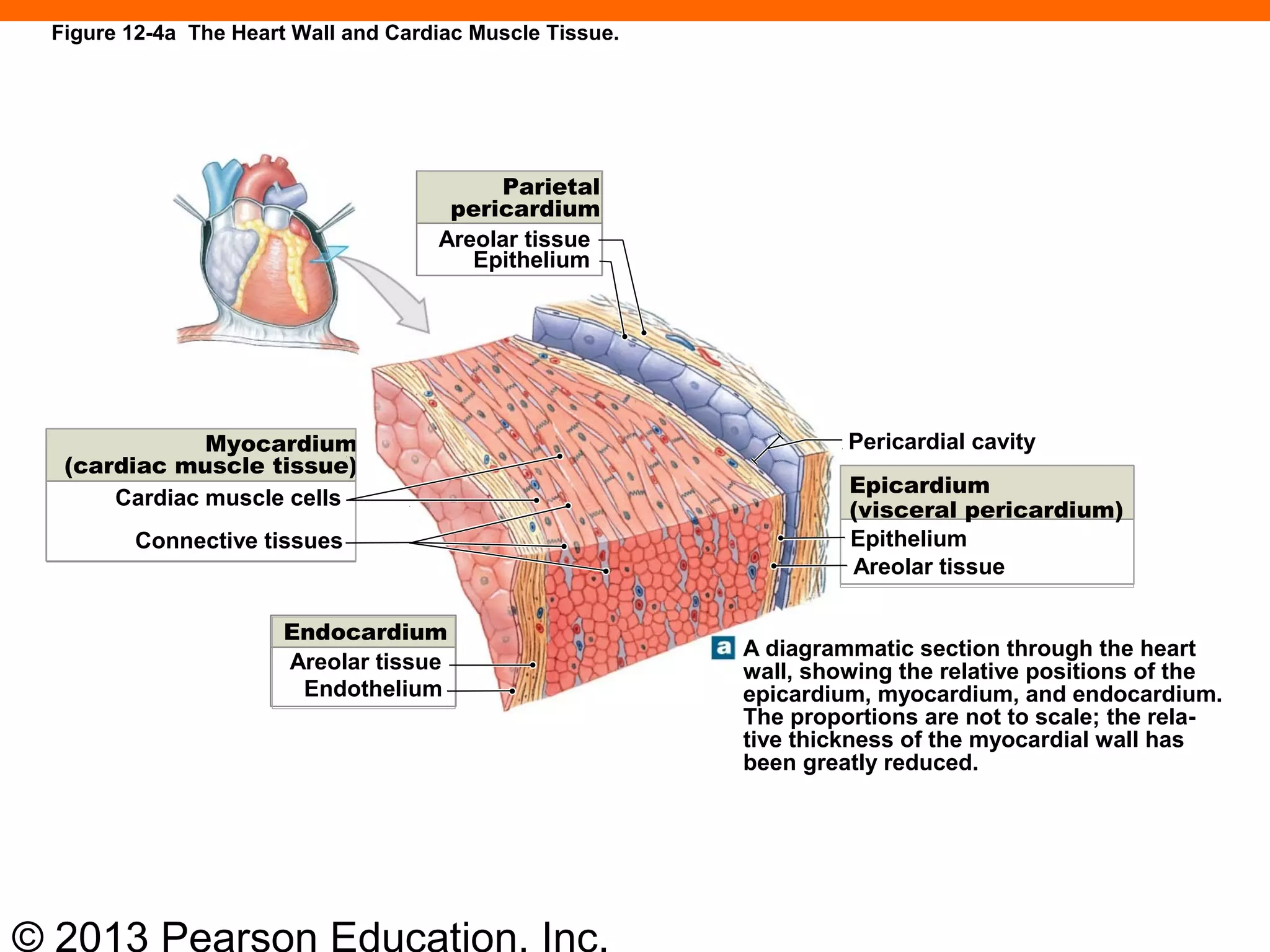 © 2013 Pearson Education, Inc.
Figure 12-4a The Heart Wall and Cardiac Muscle Tissue.
Areolar tissue
Epithelium
Cardiac muscle cells
Connective tissues
Areolar tissue
Endothelium
Pericardial cavity
Epithelium
Areolar tissue
Parietal
pericardium
Myocardium
(cardiac muscle tissue)
Epicardium
(visceral pericardium)
Endocardium
A diagrammatic section through the heart
wall, showing the relative positions of the
epicardium, myocardium, and endocardium.
The proportions are not to scale; the rela-
tive thickness of the myocardial wall has
been greatly reduced.
 