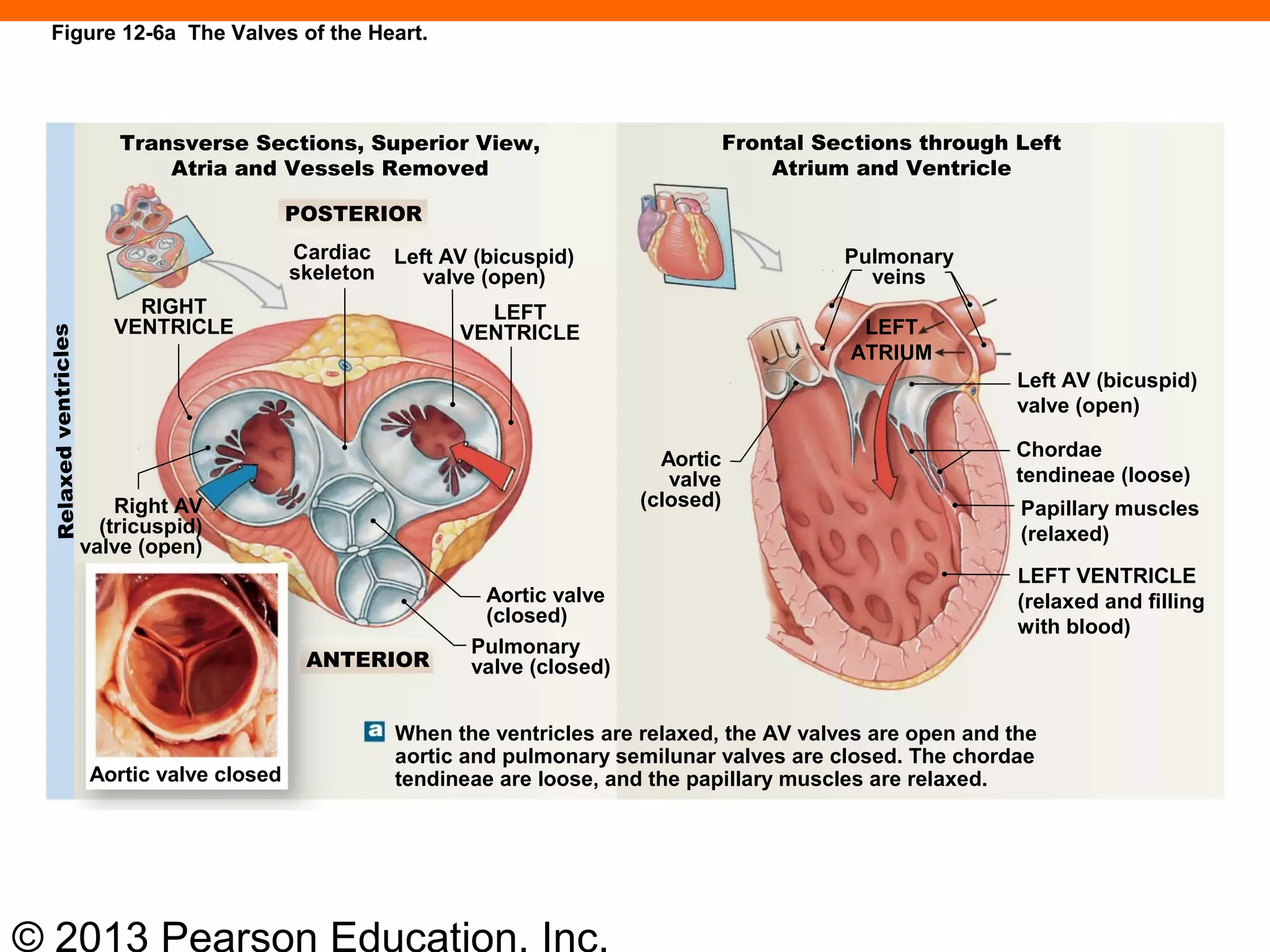 © 2013 Pearson Education, Inc.
Figure 12-6a The Valves of the Heart.
Transverse Sections, Superior View,
Atria and Vessels Removed
Frontal Sections through Left
Atrium and Ventricle
Relaxedventricles
ANTERIOR
Left AV (bicuspid)
valve (open)
Cardiac
skeleton
LEFT
VENTRICLE
RIGHT
VENTRICLE
Right AV
(tricuspid)
valve (open)
Aortic valve
(closed)
Pulmonary
valve (closed)
Pulmonary
veins
Aortic
valve
(closed)
LEFT
ATRIUM
Left AV (bicuspid)
valve (open)
Chordae
tendineae (loose)
Papillary muscles
(relaxed)
LEFT VENTRICLE
(relaxed and filling
with blood)
Aortic valve closed
When the ventricles are relaxed, the AV valves are open and the
aortic and pulmonary semilunar valves are closed. The chordae
tendineae are loose, and the papillary muscles are relaxed.
POSTERIOR
 