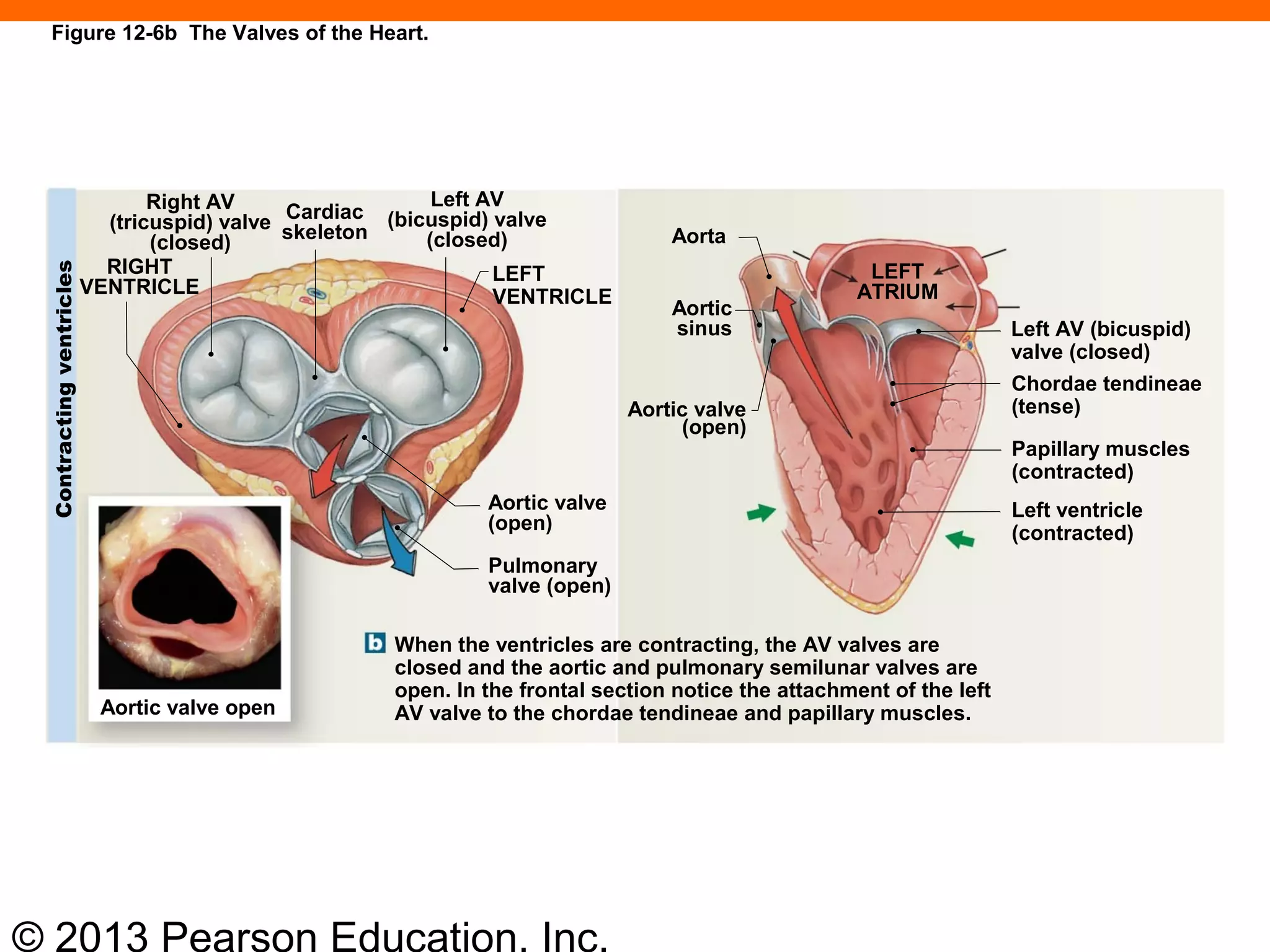 © 2013 Pearson Education, Inc.
Figure 12-6b The Valves of the Heart.
Right AV
(tricuspid) valve
(closed)
RIGHT
VENTRICLE
Cardiac
skeleton
Left AV
(bicuspid) valve
(closed)
LEFT
VENTRICLE
Aortic valve
(open)
Pulmonary
valve (open)
Aorta
Aortic
sinus
Aortic valve
(open)
LEFT
ATRIUM
Left AV (bicuspid)
valve (closed)
Chordae tendineae
(tense)
Papillary muscles
(contracted)
Left ventricle
(contracted)
When the ventricles are contracting, the AV valves are
closed and the aortic and pulmonary semilunar valves are
open. In the frontal section notice the attachment of the left
AV valve to the chordae tendineae and papillary muscles.Aortic valve open
Contractingventricles
 