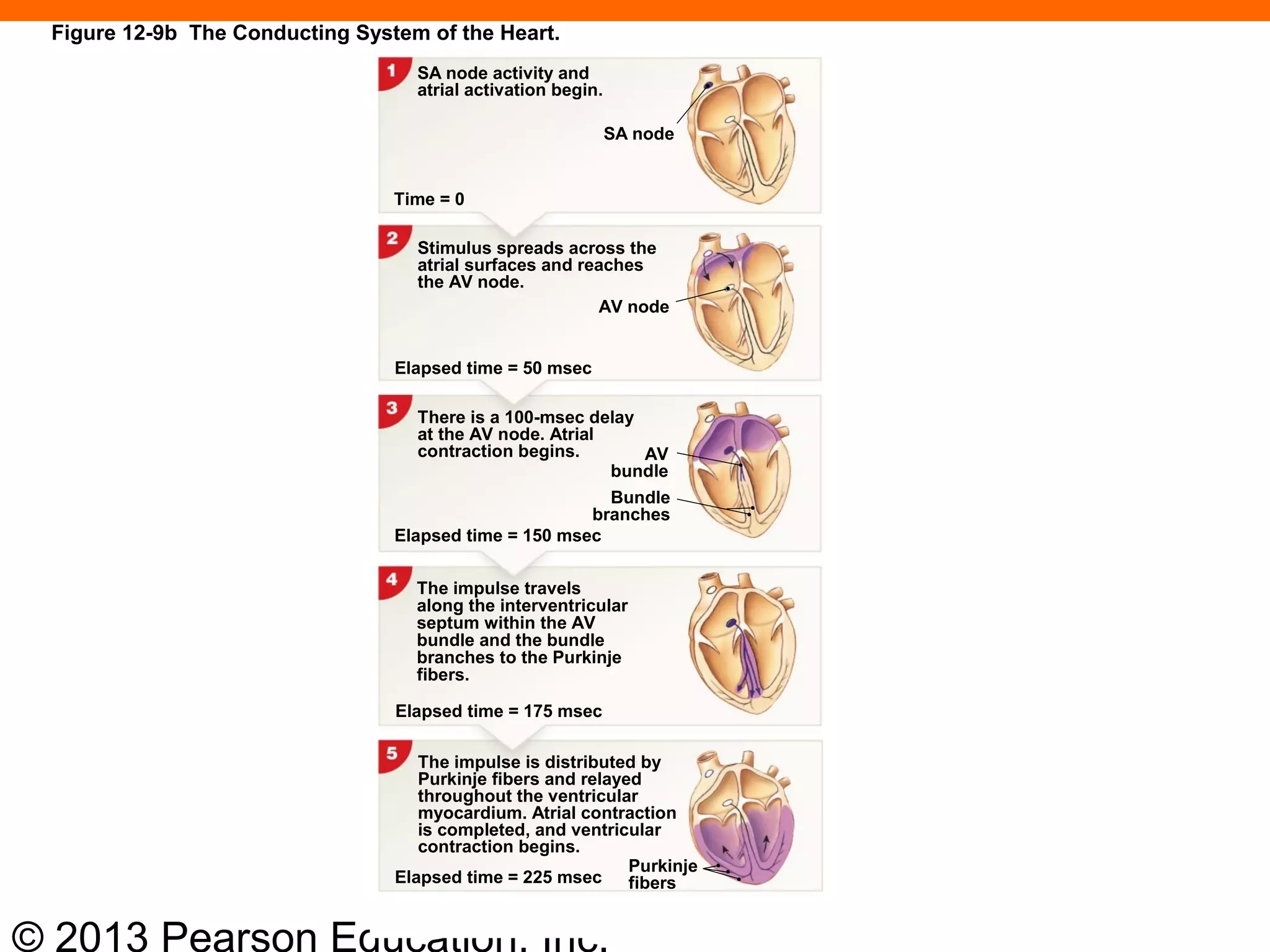 © 2013 Pearson Education, Inc.
Figure 12-9b The Conducting System of the Heart.
AV
bundle
SA node activity and
atrial activation begin.
SA node
Time = 0
Stimulus spreads across the
atrial surfaces and reaches
the AV node.
AV node
Elapsed time = 50 msec
There is a 100-msec delay
at the AV node. Atrial
contraction begins.
Elapsed time = 150 msec
The impulse travels
along the interventricular
septum within the AV
bundle and the bundle
branches to the Purkinje
fibers.
Elapsed time = 175 msec
The impulse is distributed by
Purkinje fibers and relayed
throughout the ventricular
myocardium. Atrial contraction
is completed, and ventricular
contraction begins.
Elapsed time = 225 msec
Purkinje
fibers
Bundle
branches
 