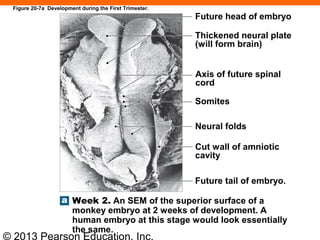 © 2013 Pearson Education, Inc.
Future head of embryo
Thickened neural plate
(will form brain)
Axis of future spinal
cord
Somites
Neural folds
Cut wall of amniotic
cavity
Future tail of embryo.
Week 2. An SEM of the superior surface of a
monkey embryo at 2 weeks of development. A
human embryo at this stage would look essentially
the same.
Figure 20-7a Development during the First Trimester.
 