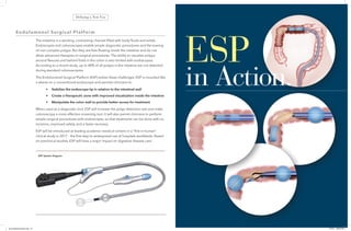 Endolumenal Surgical Platform
The intestine is a winding, contracting channel filled with body fluids and solids.
Endoscopes and colonoscopes enable simple diagnostic procedures and the snaring
of non-complex polyps. But they are free-floating inside the intestine and do not
allow advanced therapies or surgical procedures. The ability to visualize polyps
around flexures and behind folds in the colon is also limited with endoscopes.
According to a recent study, up to 40% of all polyps in the intestine are not detected
during standard colonoscopies.
The Endolumenal Surgical Platform (ESP) solves these challenges. ESP is mounted like
a sleeve on a conventional endoscope and permits clinicians to:
	 • 	 Stabilize the endoscope tip in relation to the intestinal wall
	 • 	 Create a therapeutic zone with improved visualization inside the intestine
	 • 	 Manipulate the colon wall to provide better access for treatment
When used as a diagnostic tool, ESP will increase the polyp detection rate and make
colonoscopy a more effective screening tool. It will also permit clinicians to perform
simple surgical procedures with endoscopes, so that treatments can be done with no
incisions, improved safety, and a faster recovery.
ESP will be introduced at leading academic medical centers in a “first in human”
clinical study in 2017 – the first step to widespread use at hospitals worldwide. Based
on preclinical studies, ESP will have a major impact on digestive disease care.
ESP System Diagram
ESP
in Action.
Defining a New Era
(id) EndoBrochureFin3.indd 6-7 2/1/16 1:38:24 PM
 