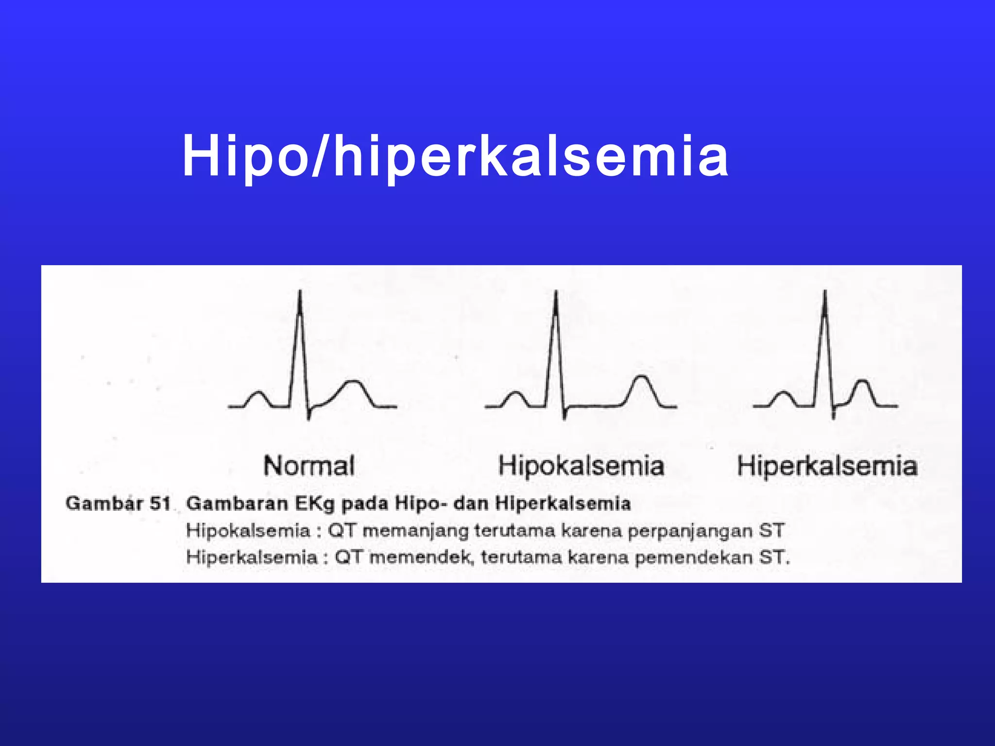 Hipo/hiperkalsemia
 