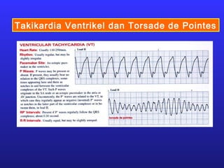 Takikardia Ventrikel dan Torsade de Pointes
 