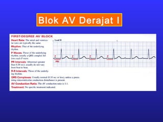 Blok AV Derajat I
 