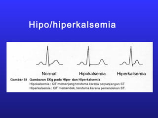 Hipo/hiperkalsemia
 