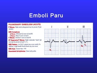 Emboli Paru
 