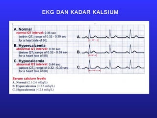 EKG DAN KADAR KALSIUM
 