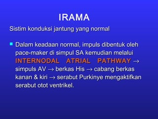 IRAMA
Sistim konduksi jantung yang normalSistim konduksi jantung yang normal
 Dalam keadaan normal, impuls dibentuk olehDalam keadaan normal, impuls dibentuk oleh
pace-maker di simpul SA kemudian melaluipace-maker di simpul SA kemudian melalui
INTERNODAL ATRIAL PATHWAYINTERNODAL ATRIAL PATHWAY →→
simpuls AVsimpuls AV →→ berkas Hisberkas His →→ cabang berkascabang berkas
kanan & kirikanan & kiri →→ serabut Purkinye mengaktifkanserabut Purkinye mengaktifkan
serabut otot ventrikel.serabut otot ventrikel.
 