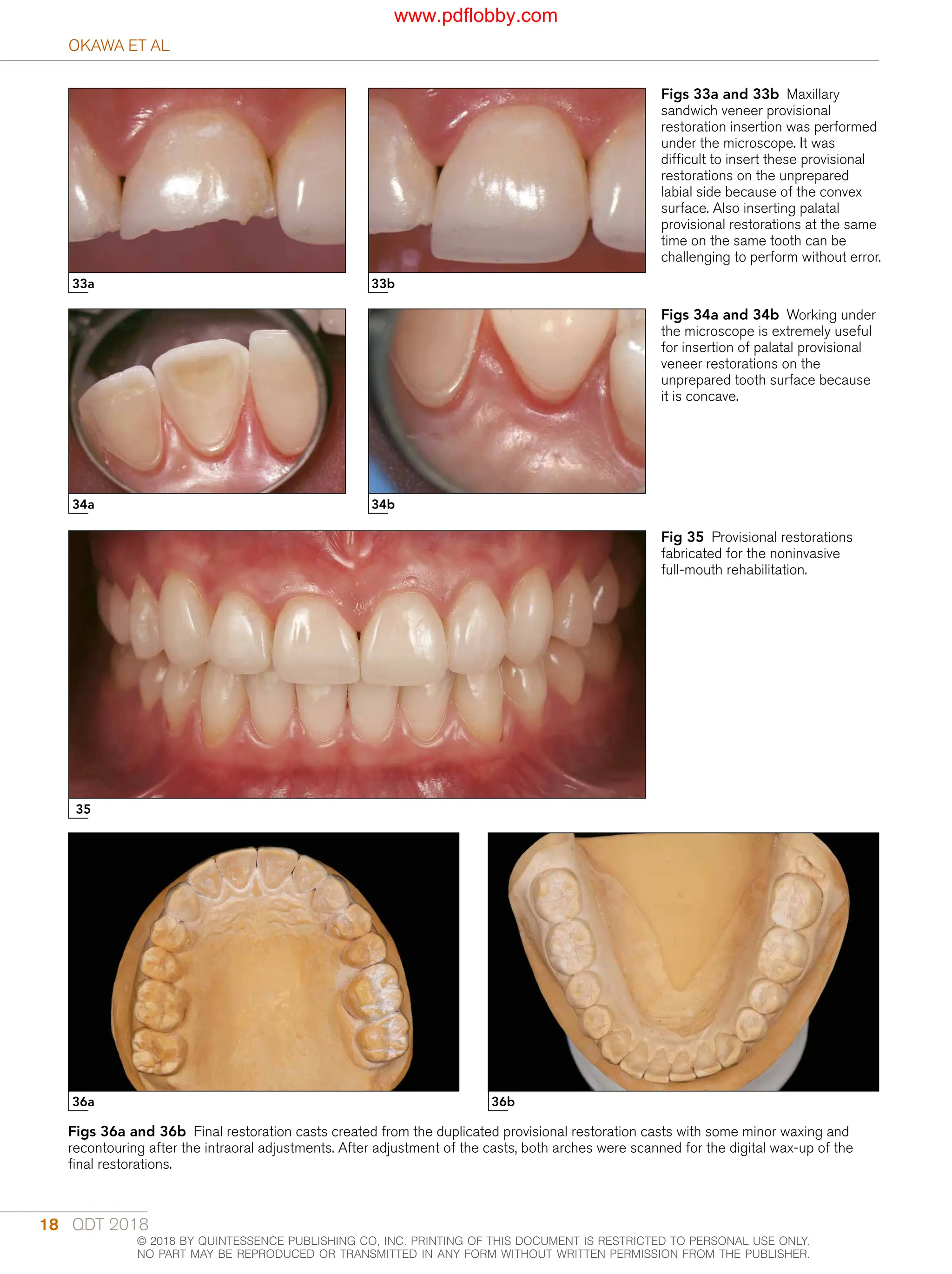 Quintessence Of Dental Technology 2018 Phd Duarte Sillas Jr Editor