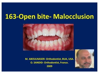 163-Open bite- Malocclusion
M. ABOULNASER- Orthodontist, BUA, USA.
O. SANDID- Orthodontist, France.
2009
 
